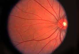 GET AN OVERVIEW ON RETINAL DISEASES THAT CAUSE CHRONIC BLINDNESS